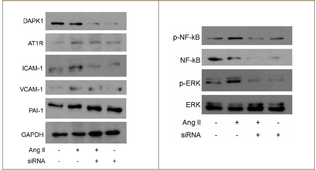 DAPK1 발현 감소에 의한 혈관 내피세포 노화 신호전달체계 발현 확인