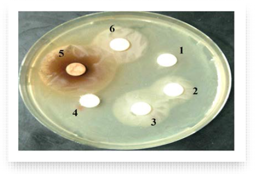 초임계 열처리된 무 복합추출물(HRE) 및 활성분획물에 장내 세균 균주에 대한 생육억제환 효과(오른쪽 그림)