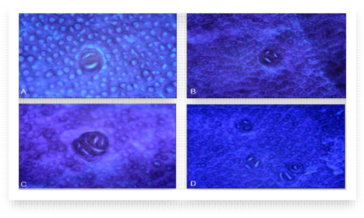 ACF is observed in the colonic mucosa of F344 rats treated with DMH(methylene blue staining(×40)). A: ACF with 2AC, B: ACF with 3AC, C: ACF with 6AC, D: diverse ACF