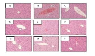 Hematoxylin & Eosin (H&E) staining of sections of the liver of mice in group (A) control, (B) acetaminophen, (C) NAC, (D) apple, (E) pear, (F) carrot, (G) broccoli, (H) cabbage and (I) radish. Images were taken at a magnification of 20x under a microscope