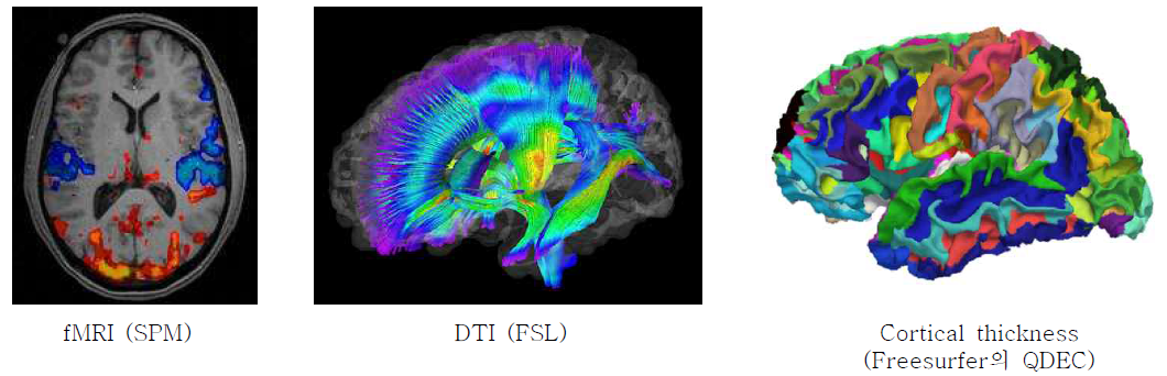 본 연구에서 사용된 뇌영상 촬영과 분석기법
