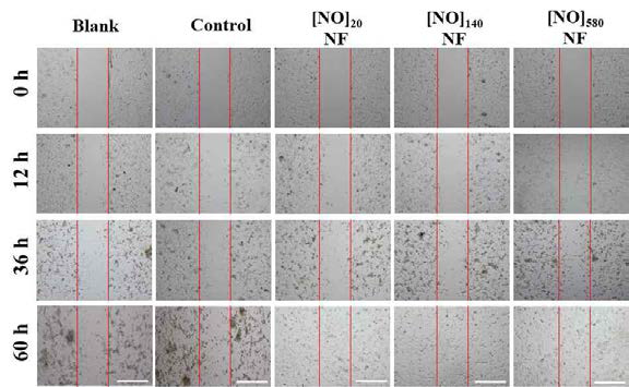 NO 저장·전달 HA 기반 나노섬유의 세포독성평가