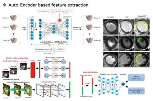 기계학습을 이용한 영상의 feature extraction