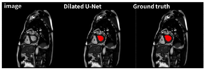 U-net 기반의 segmentation