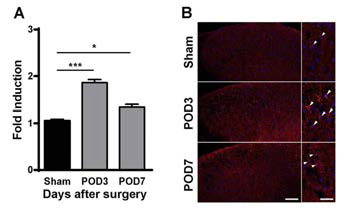 Foxp3 expression in rats with SNL-induced neuropathic pain