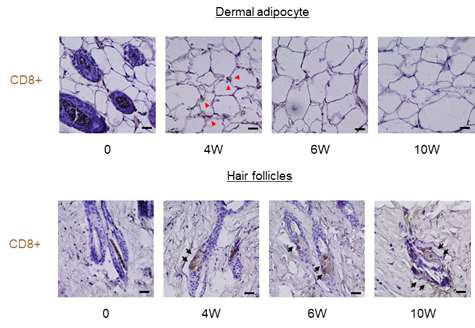 CD8+ T cells were migrated from dWATs into hair follicles