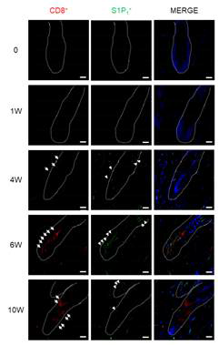 CD8+ and S1P1+ expressions were markedly appeared in hair follicle bulge