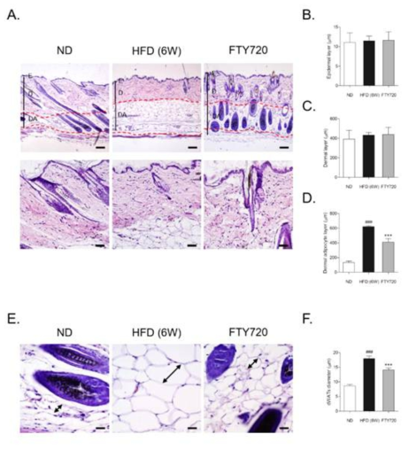 FTY720 ameliorated the destruction of hair follicles, along with decreases of dermal adipocyte layer and dWATs size