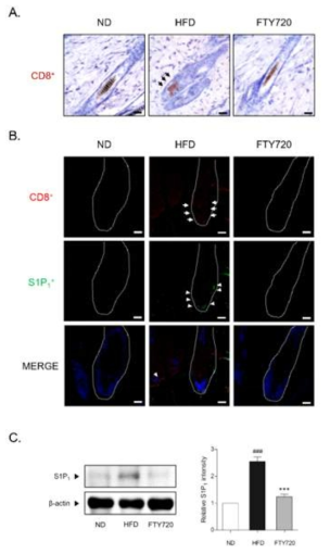 The infiltration of CD8+ T cell in hair follicles, mediated by S1P1 was inhibited by FTY720 administration