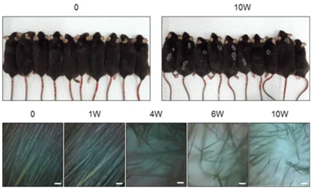 Hair loss occurred in HFD-induced obese mice