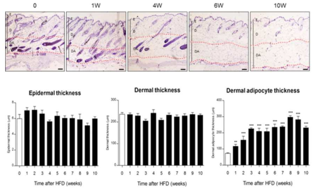 Hair follicles affected by obesity were broken and fragmented with increment of dermal adipocyte layer