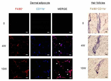 Inflammatory M1-like macrophages were accumulated in dWATs, not hair follicles