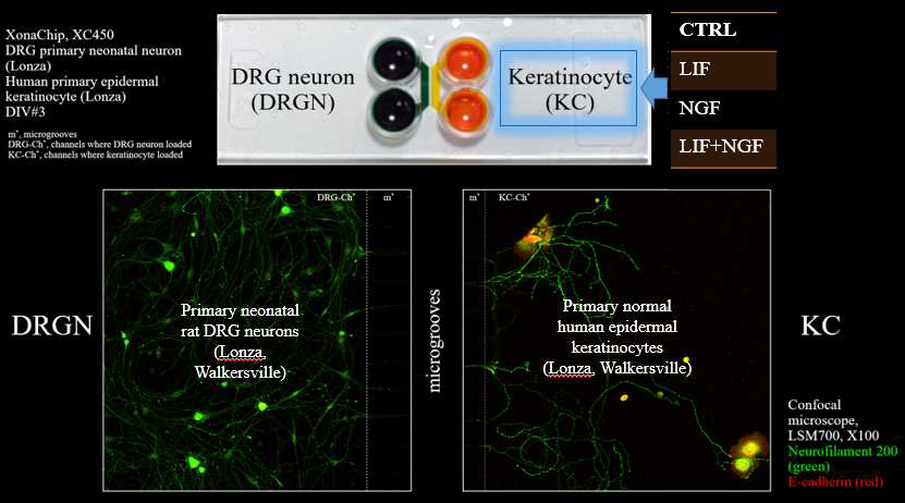 XonaChip 등을 이용한 각질형성세포(Keratinocyte, KC) 와 DRG 신경세포 (dorsal root ganglion neuron, DRGN) 의 공생배양 모델 확립