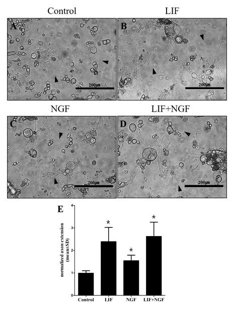 DRG 신경세포에 LIF와 NGF 단독 혹은 병합 처리 시 신경돌기 (neurite) 성장 여부 및 정도 비교