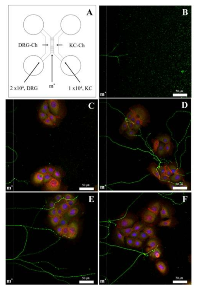 DRG 신경세포와 각질형성세포의 공생 배양 모델에서 LIF와 NGF 단독 혹은 병합 처리 시 신경돌기 (neurite) 성장 여부 및 정도 비교