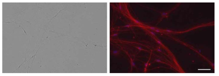 흰쥐 DRG 신경세포 (2주간 배양) (좌) DIC image, (우) Immunocytochemistry (Red : Neurofilament 200, Blue : Hoechst), scale bar = 50um