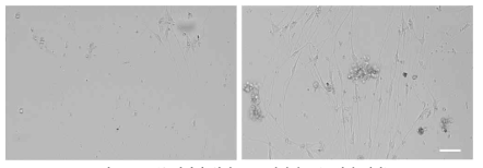 NGF를 처리한 흰쥐 DRG 신경세포 (12일간 배양) (좌) 대조군, (우) NGF 처리(100ng/ml), scale bar = 50um