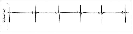 long-term experiment 통해 측정된 쥐 심장의 ECG 파형