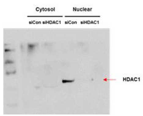 조절 B 세포 내 HDAC1 결핍유도