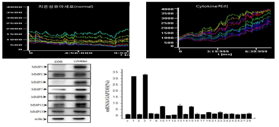 cytokine으로 자극한 치은섬유아세포에서 ROS생성 및 MMPs발현 확인