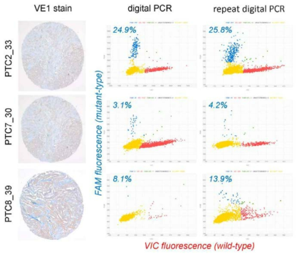 BRAF V600E 분자검사 및 VE1 면역염색 불일치 증례에서 시행된 droplet digital PCR 예