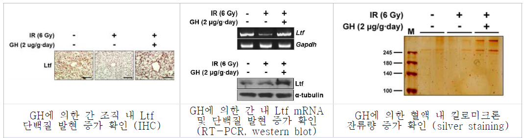 NAFLD 모델에서 GH 처리에 따른 Ltf 발현 및 혈액 내 킬로미크론 잔류량 변화 확인