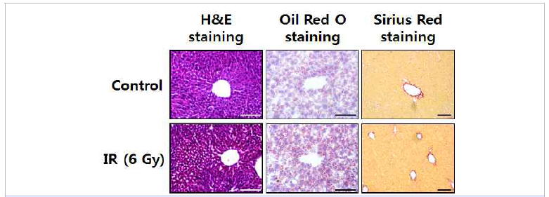 내분비계 교란-유도 NAFLD 마우스의 간 조직 변화 확인