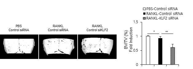 KLF2-siRNA가 RANKL에 의한 골 손실에 미미치는 영향