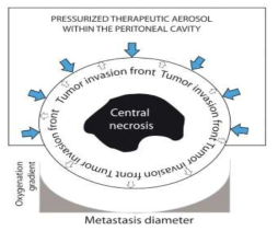 가압식 복강내 에어로졸 항암화학요법의 치료기전