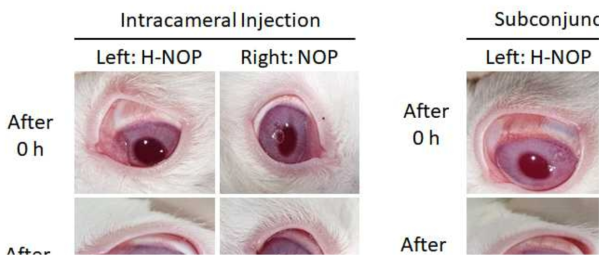 산화질소 방출 소립자를 전방내와 결막하로 주사하였을 때 48시간까지 염증, 부종, 충혈 등의 심각한 부작용이 관찰되지 않았음
