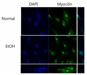 일차배양한 사람 섬유주세포의 morphology 확인을 위해 confocal image 확인