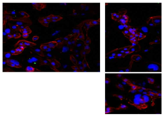 Alexa 488 conjugated bioparticle을 일차배양한 사람 섬유주세포에 처리하였을 때, dexamethasone treatment 군에서 bioparticle이 extracellular 부분에 많이 존재함을 확인함