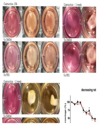 Collagen contraction assay. 일차배양한 사람 섬유주세포의 교원질 수축 정도를 확인하였을 때 2주간 collagen gel 지름의 약 75~80%가 감소함을 확인하였음