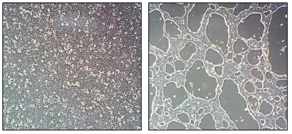 Representative cytopathic effect of rotavirus infected vero cells. (A:normal cells, B:infected cells.)