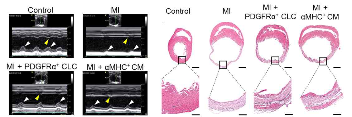 PDGFRα+ 심장근 전구세포 이식 후 심근 경색 모델에서 심장 기능과 조직학적 소견 개선