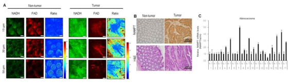 대장암 환자 조직에서의 NAMPT 과발현에 의한 NADH pool 증가 확인 (A) Two-photon macroscopy를 통한 NADH pool imaging. (B) IHC를 통한 NAMPT 과발현 확인. (C) NAMPT mRNA level 확인. published in Cancer Science
