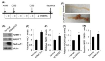 AOM/DSS-induced colon cancer model을 통한 tumor tissues에서 NAMPT의 과발현 확인. (A) AOM/DSS treatment 실험 모식도. (B) AOM/DSS-induced colon cancer images. (C) Tumor tissues에서의 NAMPT 과발현 확인. (D) NAMPT 과발현에 따른 NADH pool 증가 확인. published in Cancer Science