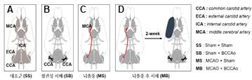 뇌졸중후 치매 동물모델 제작 뇌졸중 동물모델에서 양측 총경동맥 결찰 (MB)하여, 대조군 (SS), 혈관성 치매모델 (SB) 뇌졸중 모델 (MS)과 비교함
