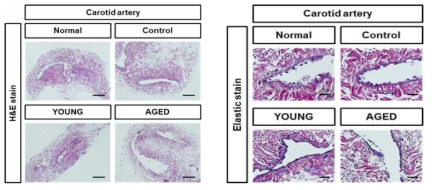 노화정도가 다른 지방줄기세포 분비 배양액 이식 후, 경동맥의 조직학적 분석