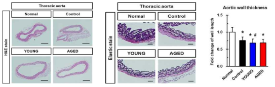 노화정도가 다른 지방줄기세포 분비 배양액 이식 후, 대동맥의 조직학적 분석 (좌, 중) 및 대동맥 혈관벽 두께 정량화 (우)