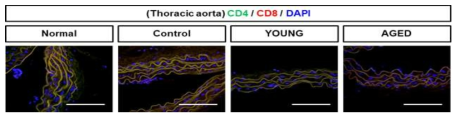 대동맥 조직에서 CD4 및 CD8 발현을 통한 면역/염증세포 침윤성 분석