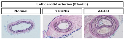 노화정도가 다른 지방줄기세포 분비 배양액을 의인성 동맥경화 동물모델에 이식 28일 후, 경동맥의 조직학적 분석