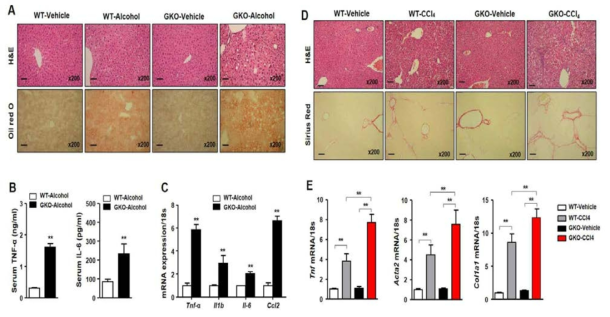 GDF15KO 모델에서 알콜과 CCL4에 의한 injury조건에서 표현형 분석