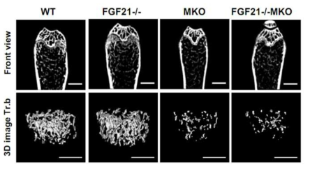 FGF21KO와 FdKO마우스의 뼈 표현형 분석