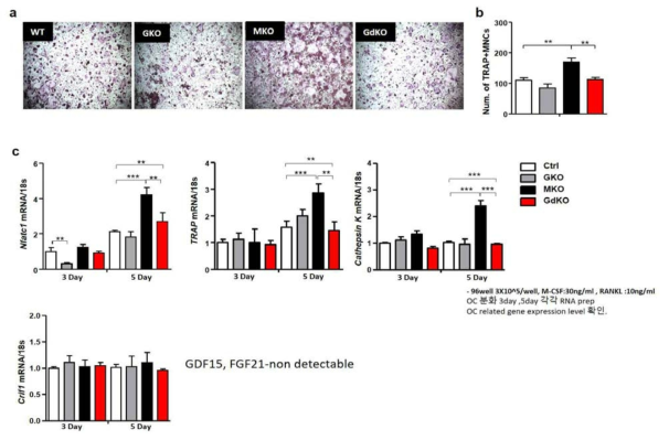 GdKO마우스에서 GDF15에 의한 osteoclast 분화 조절