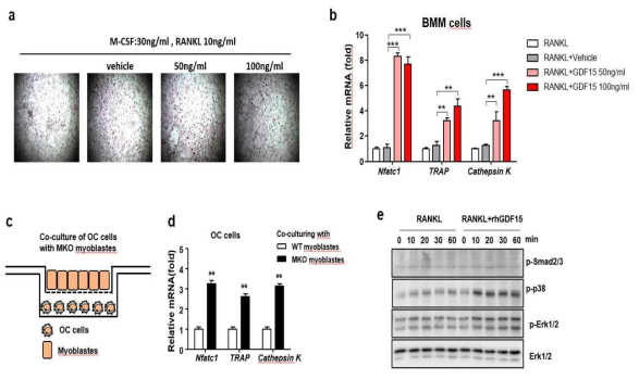 GDF15에 의한 osteoclast 분화능 유도