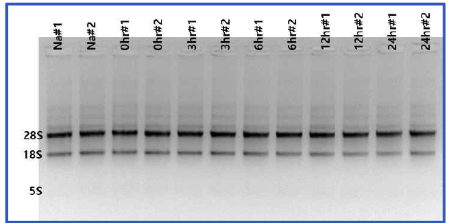 1% TAE gel을 이용한 Total RNA quality 분석