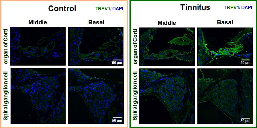 이명 후 말초청각기관의 TRPV1 변화