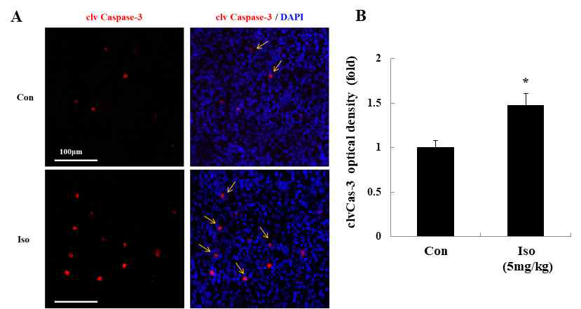 이종이식 종양모델 (in vivo tumor xenograft model)에서 EF#2(isolinderalactone)를 주입 후, 종양 조직내에서의 세포사멸마커(cleaved caspase-3) 의 감소 검증