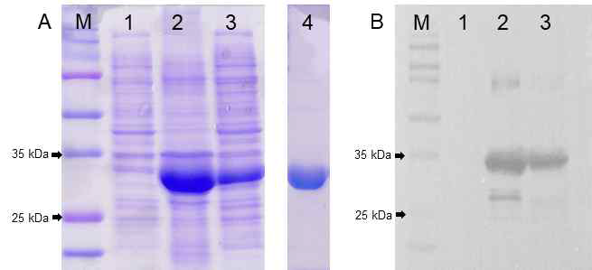 Expression, Purification and Western-blot analysis of PvLDH